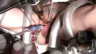 Urinröret klingande med e-stim